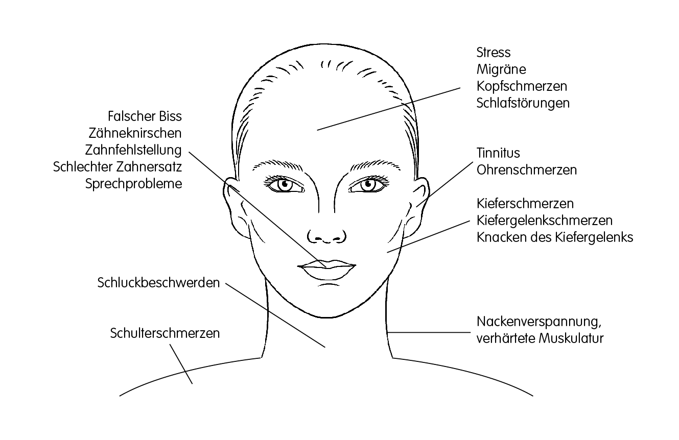 Aligner - Zahnkorrektur leicht gemacht